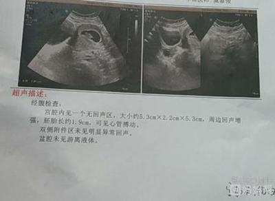 怀孕60天胚芽多大正常