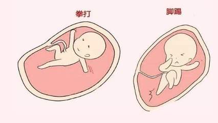 胎儿发育畸形