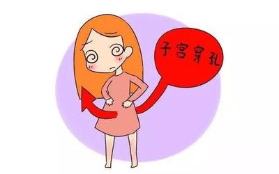 人流是怎么回事