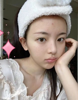 小女生脸上长痘痘怎么去除