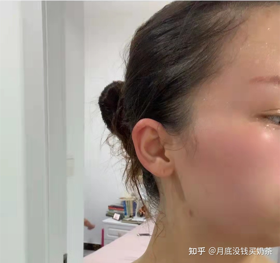 额头总出汗是怎么回事