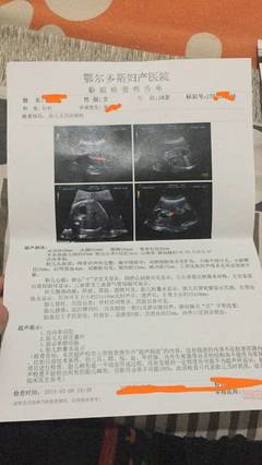 肾囊肿可以怀孕吗