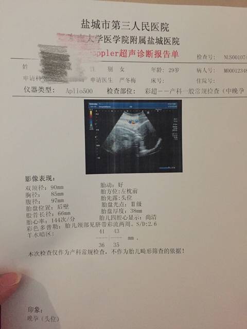 怀孕36周脐带绕颈两周怎么办