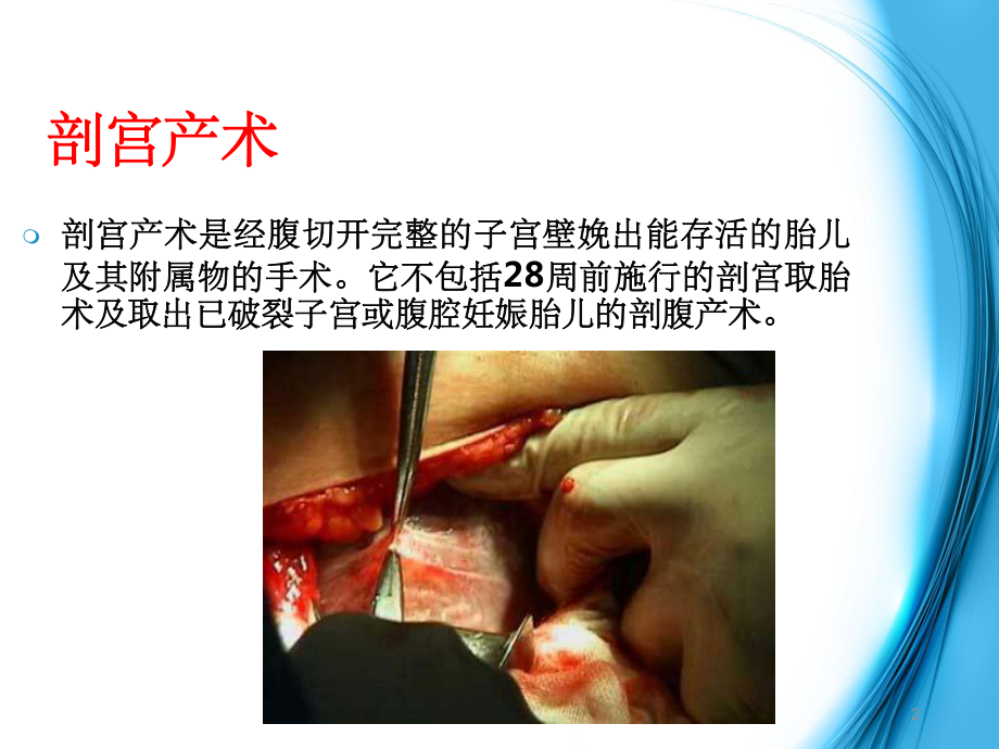 胎儿附属物包括