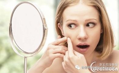 痘痘怎样挤才算挤干净