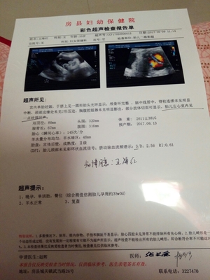 35周胎儿图片