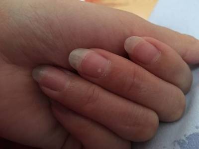 不知道怀孕做了指甲