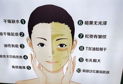 冬天鼻子里痘痘