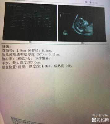 怀孕3个半月胎儿有多大