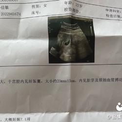 怀孕五周肚子疼是怎么回事