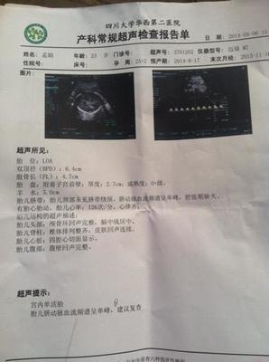 孕妇需要做心脏彩超吗