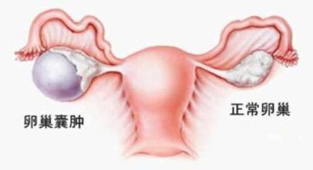 排卵期出血症状及血量