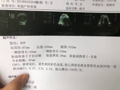 徐州97医院体检多少钱