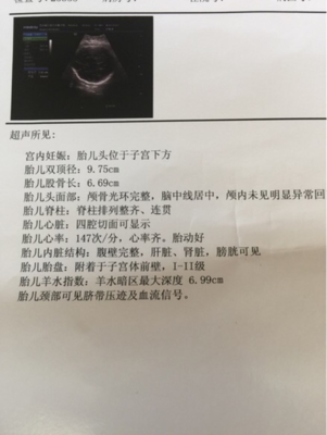 胎儿心跳过快是什么原因