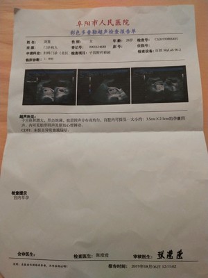 药物流产的最佳时间是几天?药物流产过程