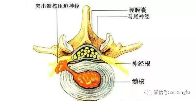 什么病需要静养半个月