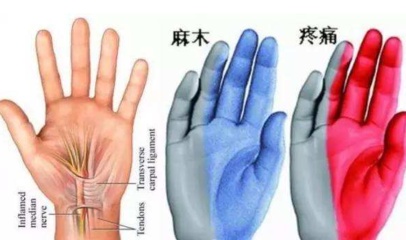 手指抖是怎么回事