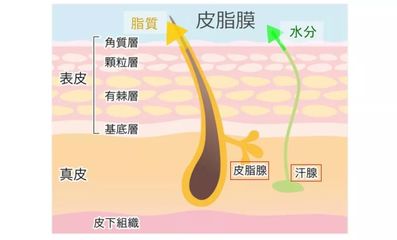 不出白头的痘痘是什么