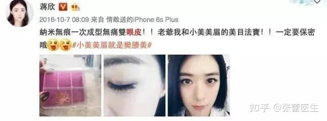 双眼皮有几种做法