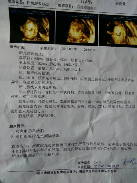 怀孕25周胎儿有多大