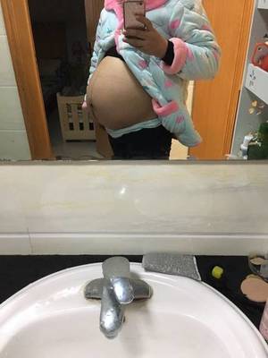 没怀孕会有妊娠线吗