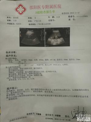 34周胎儿图片