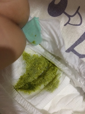 宝宝拉粑粑绿色