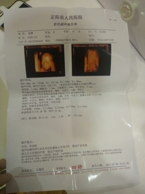 胆囊偏大是怎么回事