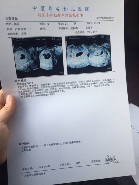 怀孕3个月胎儿多大