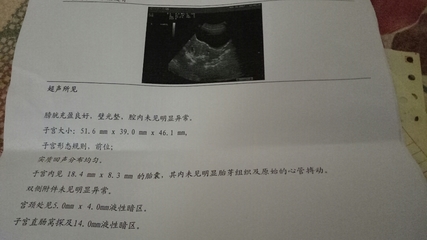胎儿一般多少天有胎心
