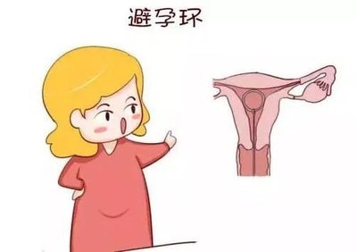 取环后是不是很难怀孕