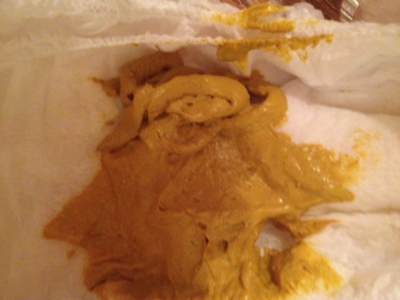 宝宝拉的粑粑黏糊糊的