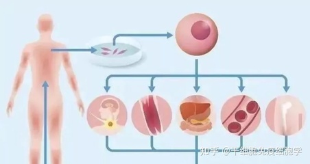 干细胞移植治疗糖尿病要多少钱