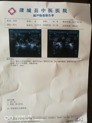 怀孕初期少量出血正常吗