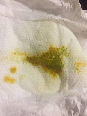 满月宝宝正常大便图片