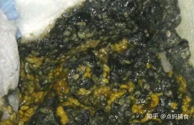 宝宝拉屎有黑色颗粒