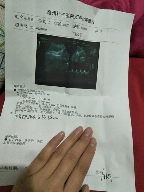 双顶径正常是多少正常吗