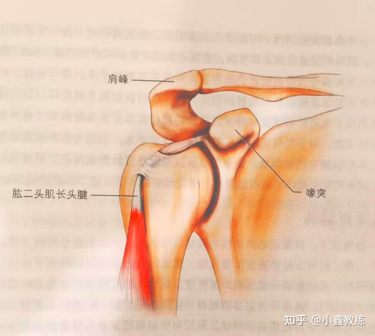 腱鞘积液是怎么回事