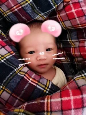 新生儿甲减症状