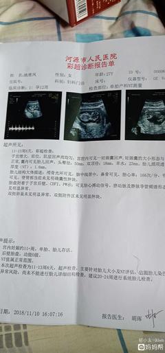 怀孕了怎么看男女