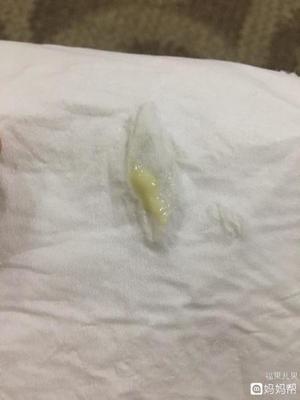 白带会怀孕吗