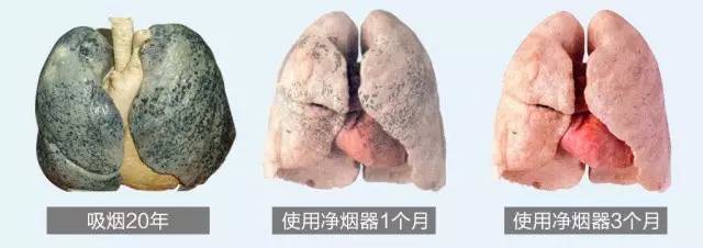 痰是灰色的怎么回事