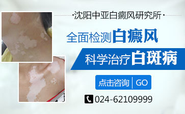 白癜风该怎么治疗好
