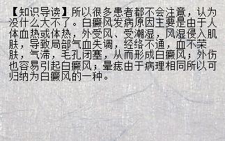 类风湿能喝奶粉吗