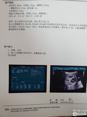 怀孕六个月做四维晚吗