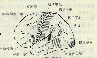 智商高的人更容易做梦吗?