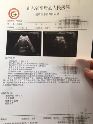 孕32周羊水多少正常