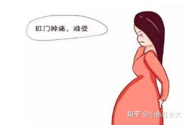 怀孕前要做痔疮手术吗
