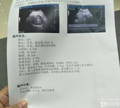 羊水39周应该是多少正常