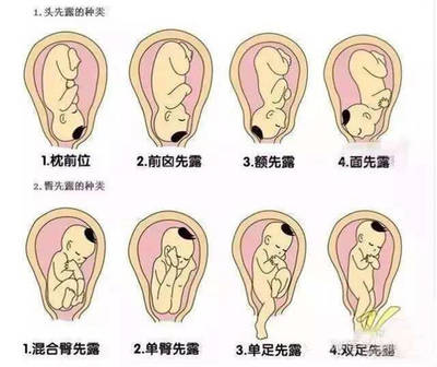 怀孕多久定胎位
